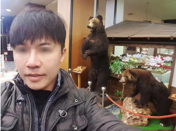 男性隆鼻+下巴手術案例,博恩妍